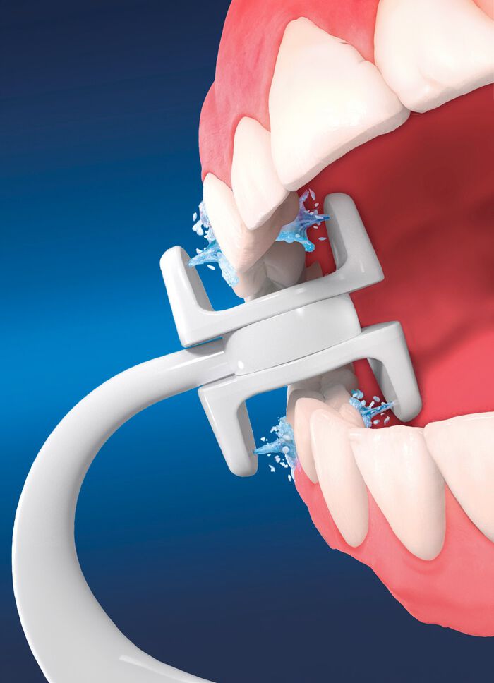Zusatzaufs&auml;tze f&uuml;r Munddusche Corp Care Miracle Smile 