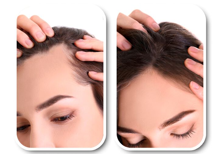 Velform&reg; Nutritional Lotion f&uuml;r jeden Haartyp 